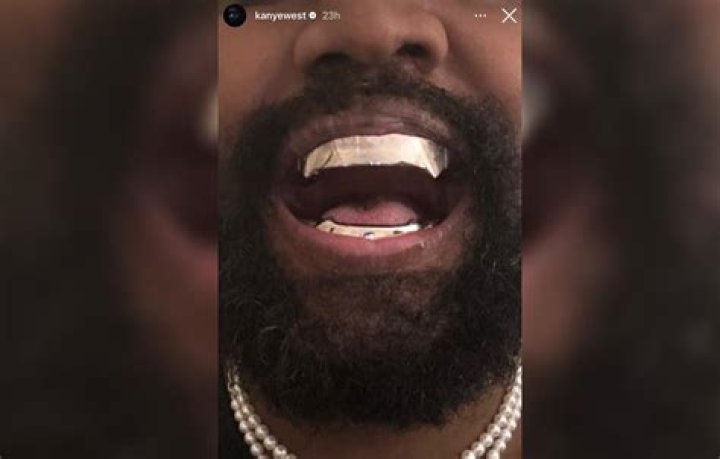 'This is what happens when you make too much money': Kanye West's New Titanium Dentures Stun Fans