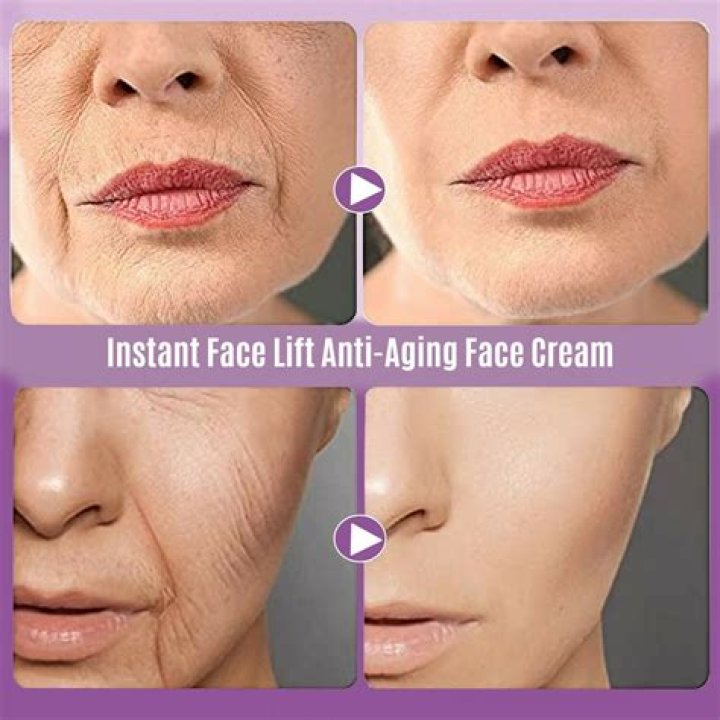 10 Best Instant Wrinkle Fillers to Achieve Instant Youthful Radiance