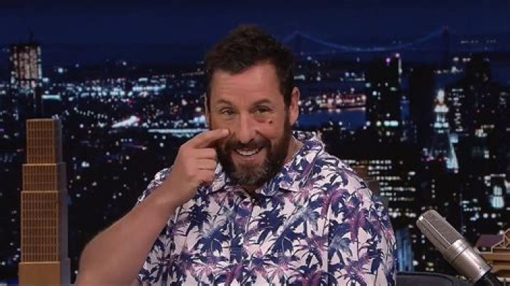Adam Sandler Face Injury: What Happened To His Eye? Phone Accident Explained