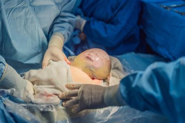 Baby Born in Amniotic Sac