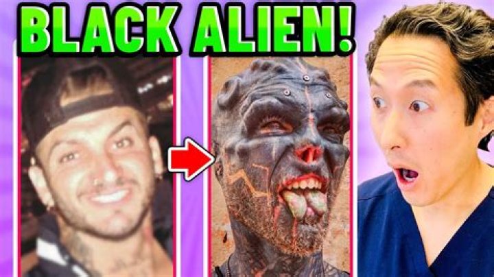 Black Alien Before And After: The Black Alien Project