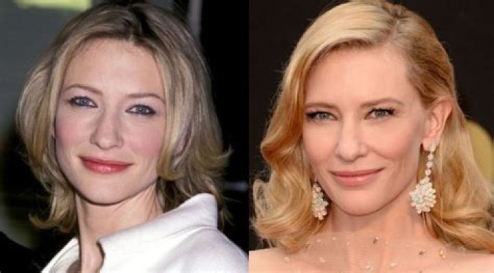 Cate Blanchett Says Plastic Surgery Is Not For Her
