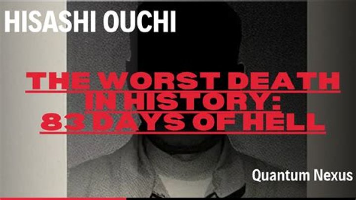 Death Of Hisashi Ouchi: A Tragic Tale Captured In Pictures