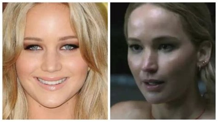 Did Jennifer Lawrence get plastic surgery done on her eyes and nose? Actress addresses rumors in a sit-down with Kylie Jenner