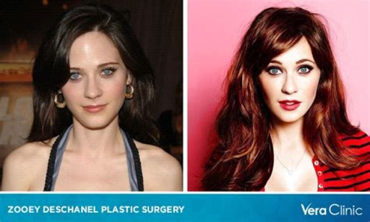 Dispelling Rumours that Zooey Deschanel Has Had Plastic Surgery.