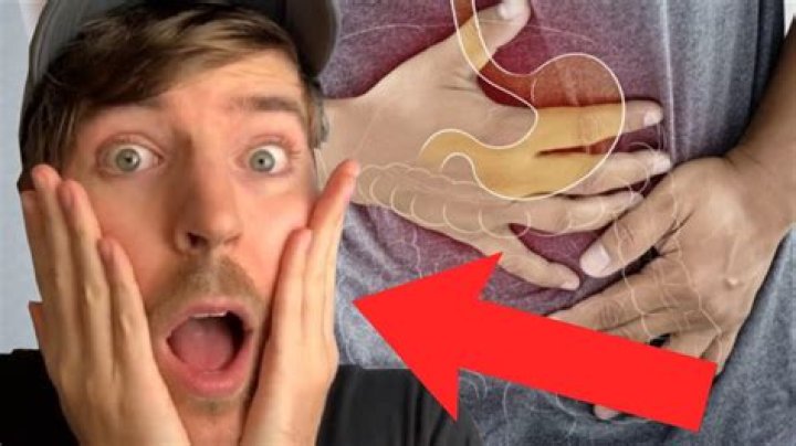 Does Mr. Beast Have Lung Cancer or Crohn's disease?