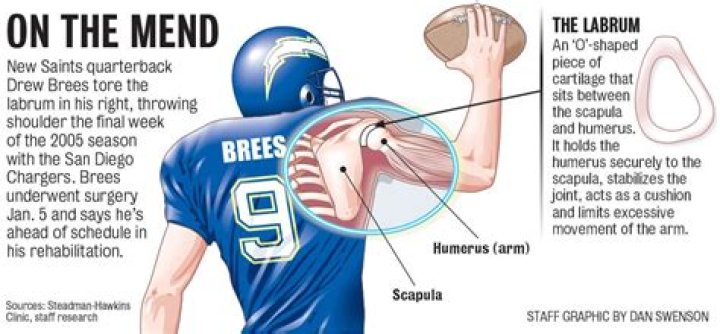 Drew Brees’ Shoulder Surgery: How He Overcame a Career-Threatening Injury and Became a Legend