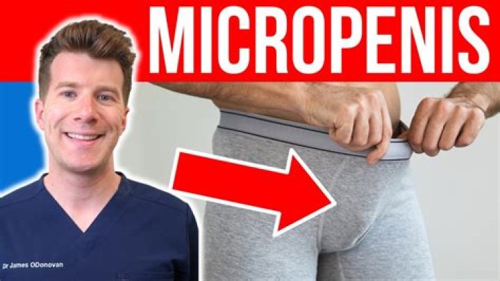 Everything to Know About Micropenises