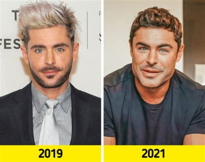Fabio Jakobsen Before And After: The Terrible Accident and Recovery