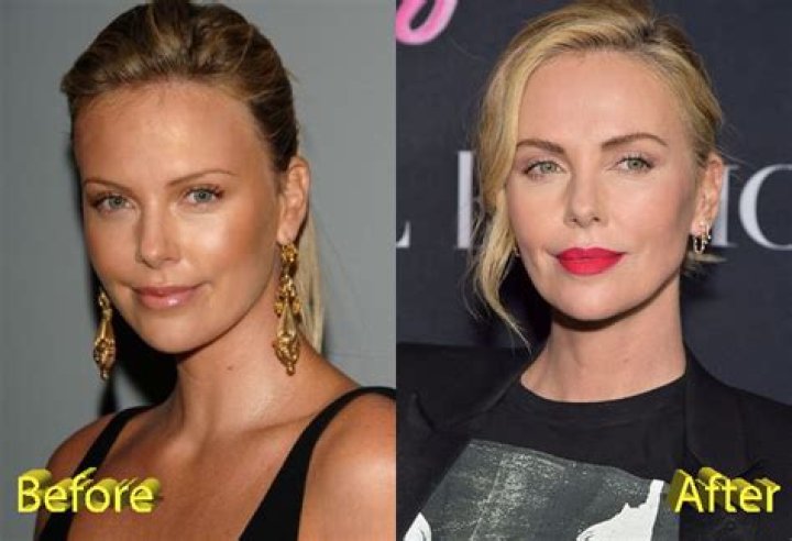 False plastic surgery rumors are denied by ‘Charlize Theron’