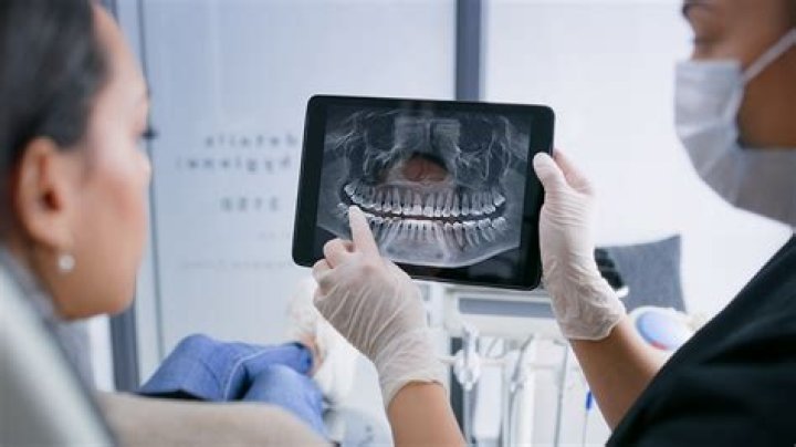 Getting a dental X-ray? A new recommendation says you don’t need a lead apron