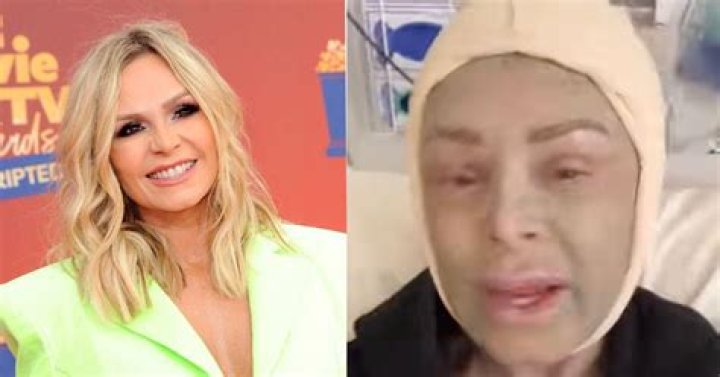 Here’s why Teresa Giudice unfollowed Tamra Judge on Instagram