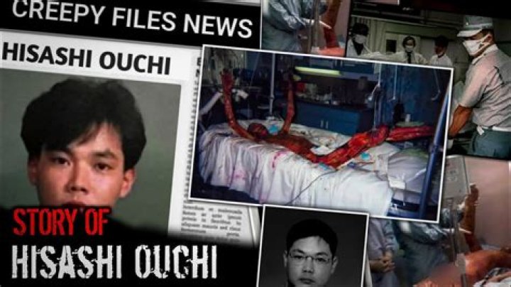 Hisashi Ouchi Real Pictures: The Tragic Story Behind The Images
