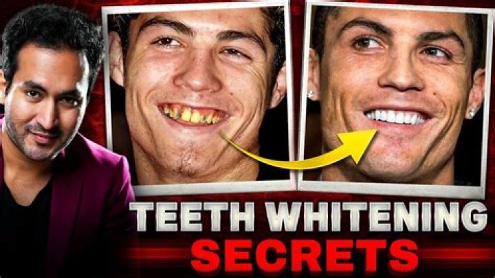 How Celebrities Whiten Their Teeth in 2024