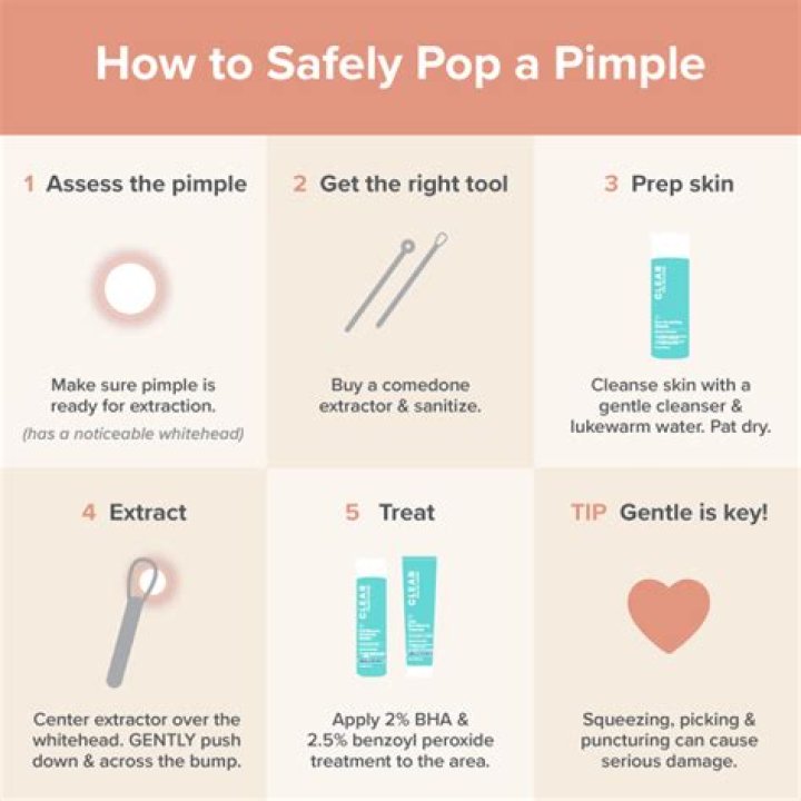 How to pop a pimple without undesirable consequences