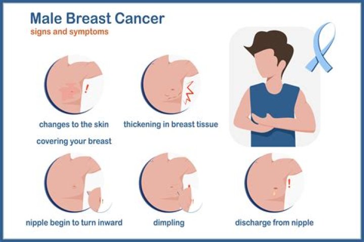 How to recognize male breast cancer