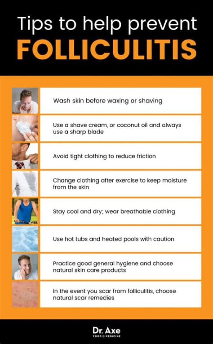 How to treat folliculitis