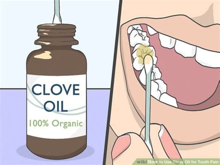 How to use clove oil for tooth pain