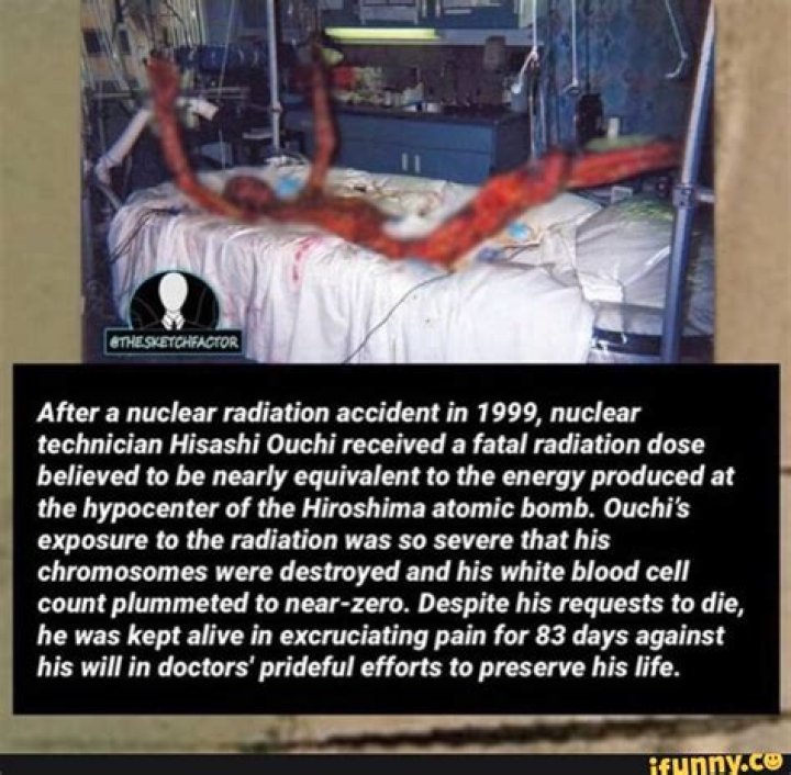 Images Of Hisashi Ouchi: The Tragic Story Behind The Nuclear Accident