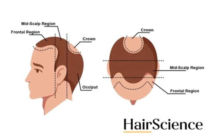 Is a bald head called a pate?