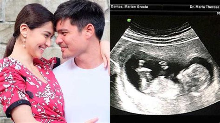Is Marian Rivera Pregnant? Is Baby No. 3 on The Board for Spanish-Filipino Actress?