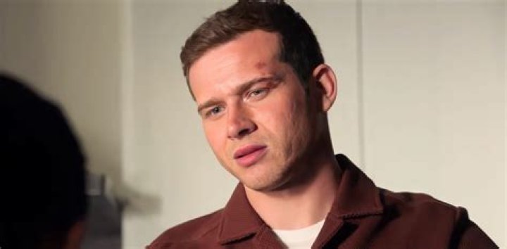 Is Oliver Stark’s (Buck) Eye Mark in 9-1-1 Real?