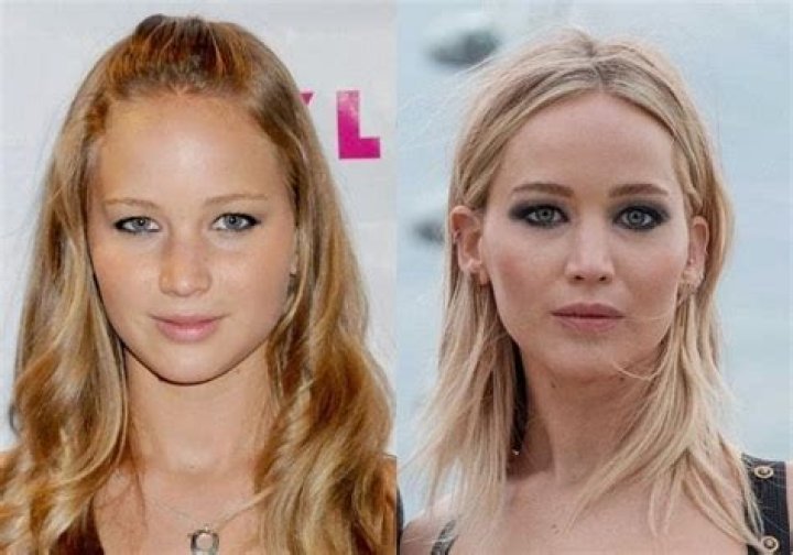 Jennifer Lawrence Chirurgie: Les rumeurs et les faits sur les interventions présumées