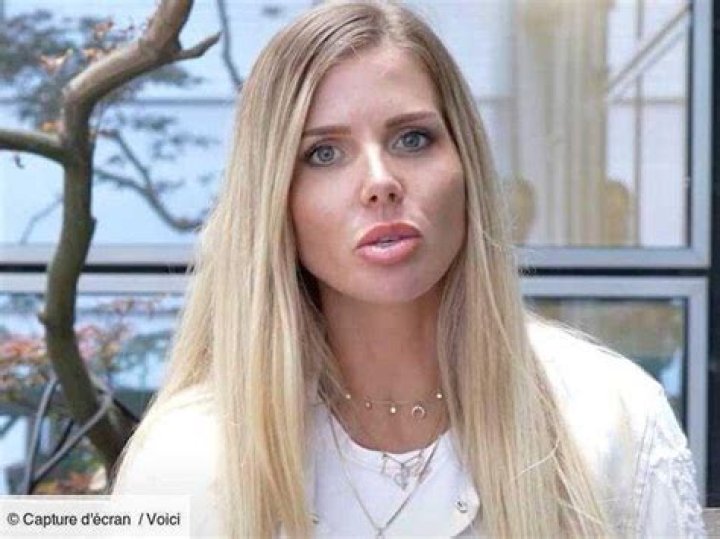 Jessica Thivenin Avant Chirurgie Esthétique: Vérités et Métamorphose de la Vedette deTéléréalité