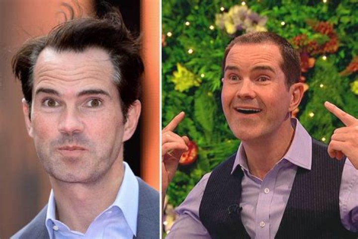 Jimmy Carr reveals dramatic transformation after getting hair transplant, botox and veneers ahead of 50th birthday