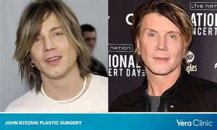 Johnny Rzeznik Plastic Surgery: How He Changed His Looks Over the Years