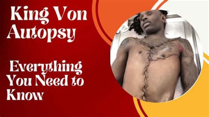 King Von Autopsy Back: Unveiling The Truth Behind The Tragic Death Of A Rising Star