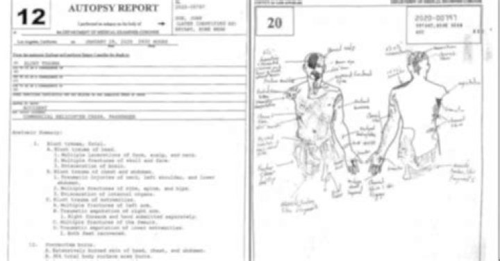 Kobe Bryant Autopsy Report Drawing: Kobe And Gigi’s Tragic Death