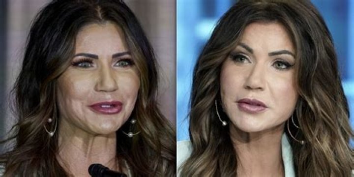 Kristi Noem Plastic Surgery: An In-Depth Look At The Transformations