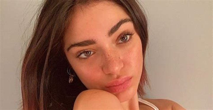 Luna Blaise’s Lip Fillers And Photoshop Rumors Explained