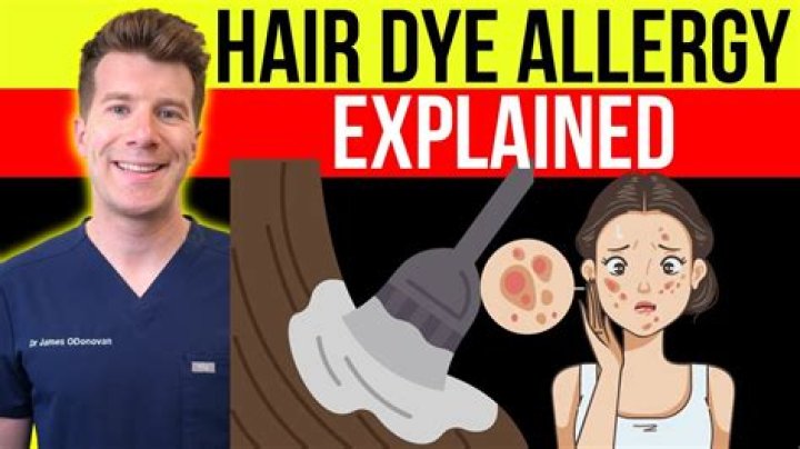 Man has shocking allergic reaction after not doing a patch test before dyeing hair - but people STILL won't bother