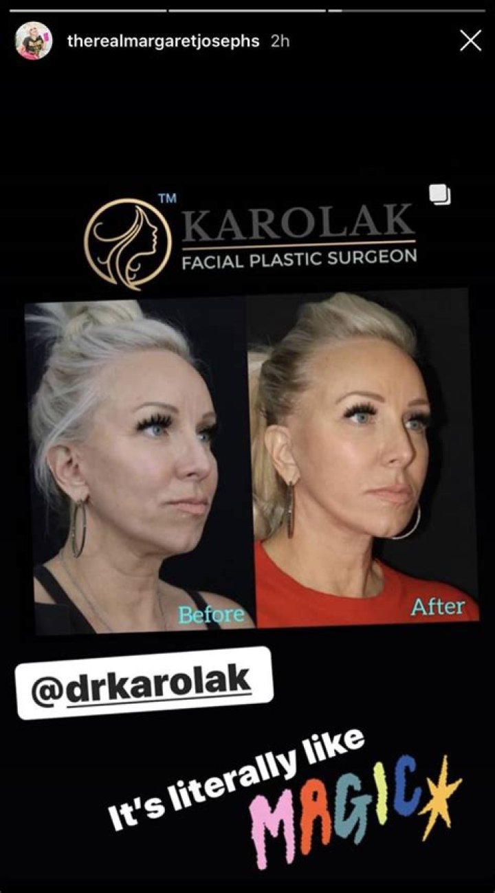 Margaret Josephs on How Plastic Surgery Impacted Her Career