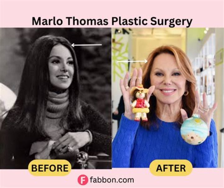 Marlo Thomas Plastic Surgery: A Timeline of Cosmetic Enhancements