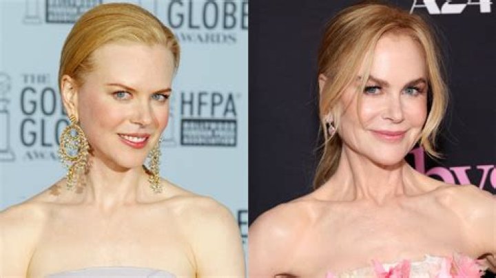 Nicole Kidman Plastic Surgery: Plastic Surgery or the Art of Aging Gracefully?