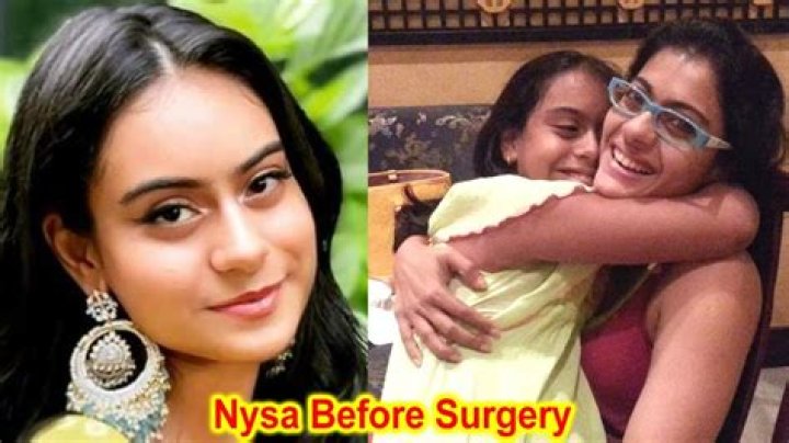 Nysa Devgan Before Surgery, Diet, Exercise, Fitness, Debut And More