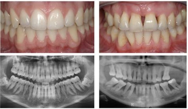 Patient gets bumper £22,000 payout after three separate dentists failed to spot his gum disease - for 12 YEARS