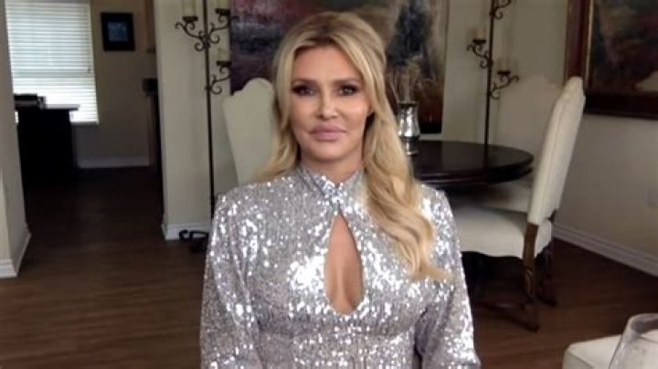 RHOBH alum Brandi Glanville denies getting plastic surgery, blames changing face on gum infection