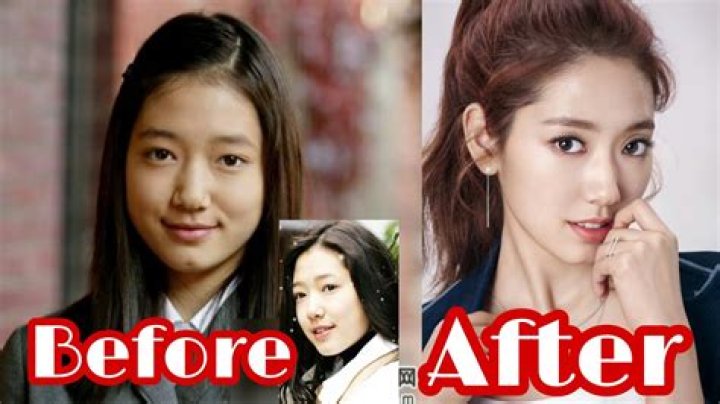 Seo Ji-Hye Before Plastic Surgery: A Deep Dive Into Her Transformation