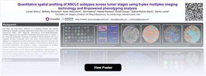 Shoreline Biosciences Presents Data at AACR 2023 Demonstrating Novel Methodology to Produce Clinical Scale iPSC-derived NK (iNK) Cells