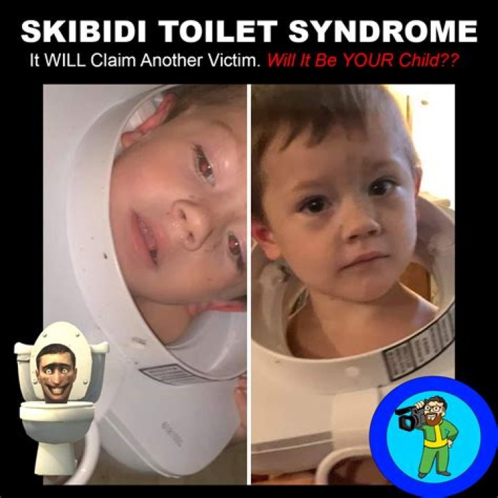 Skibidi Toilet Syndrome is the bizarre new meme disease internet users have