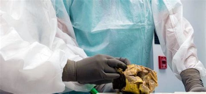Tarrare Autopsy Organs: Unveiling The Mystery Behind The Extraordinary Case
