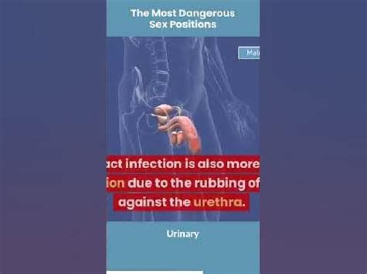The Most Dangerous Sex Position For Women, Because Let's Avoid Vaginal Tears
