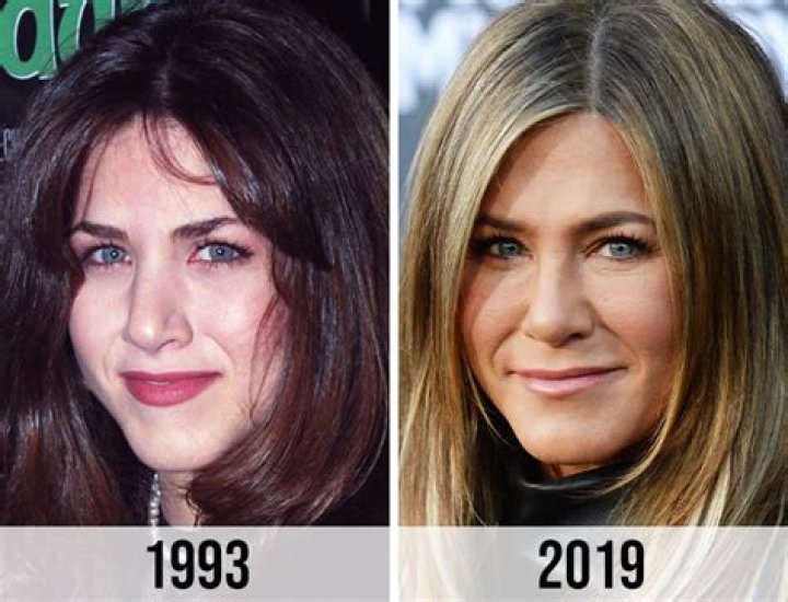 The Reality Behind Her Plastic Surgery