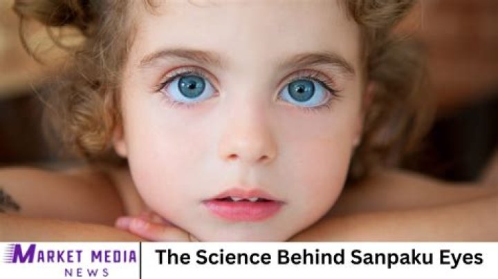 The Science Behind 'Sanpaku Eyes'