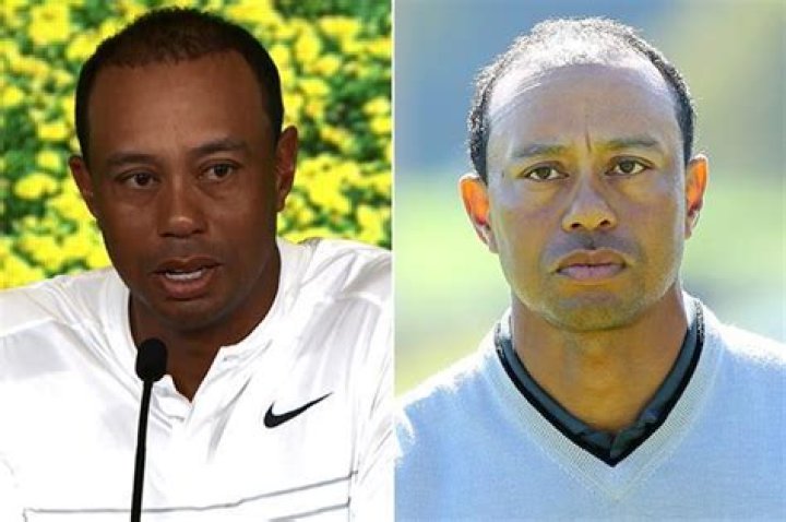 Tiger Woods' comeback complete as four-time Masters champion shows off full hairline