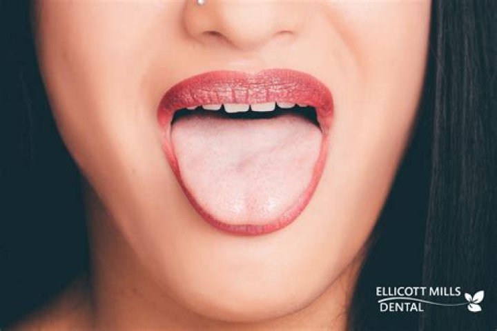 Tongue speaks volumes about hygiene, health